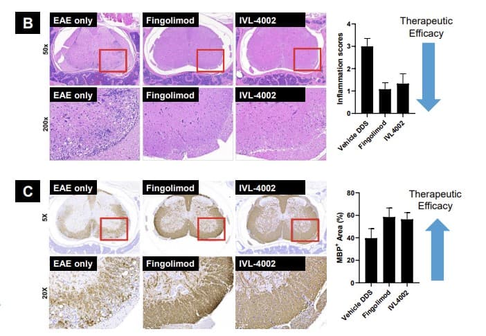 인벤티지랩, 미국면역학회(AAI)서 다발성경화증 치료제 비임상 효능결과 최초 발표